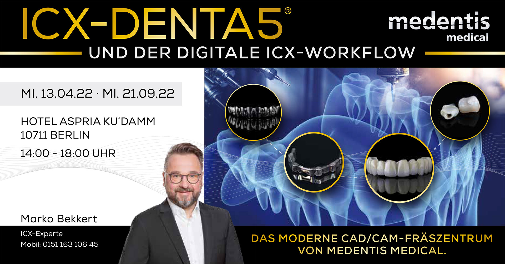 ICX-DENTA5® und der digitale ICX-Workflow ICX-DENTA5® und der digitale ICX-Workflow