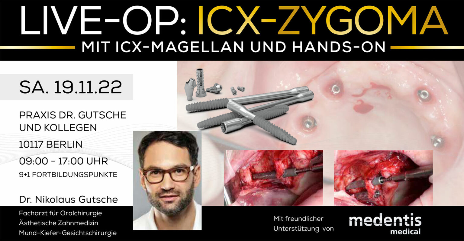 Live-OP: ICX-Zygoma – Mit ICX-Magellan und Hands-on Live-OP: ICX-Zygoma – Mit ICX-Magellan und Hands-on