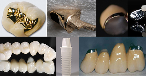 Ceramics as alternatives to metals - results from clinical trials