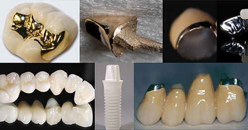 Ceramics as alternatives to metals - results from clinical trials Ceramics as alternatives to metals - results from clinical trials