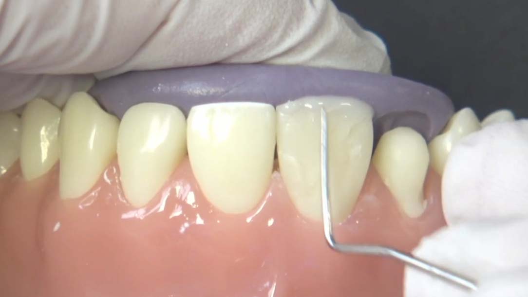 Minimalinvasive Rehabilitation Minimalinvasive Rehabilitation